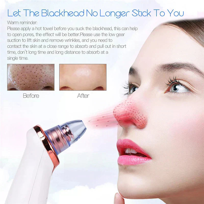 Vacuum Blackhead Remover Face Black Spots Cleaner White Dot Pimple Removal