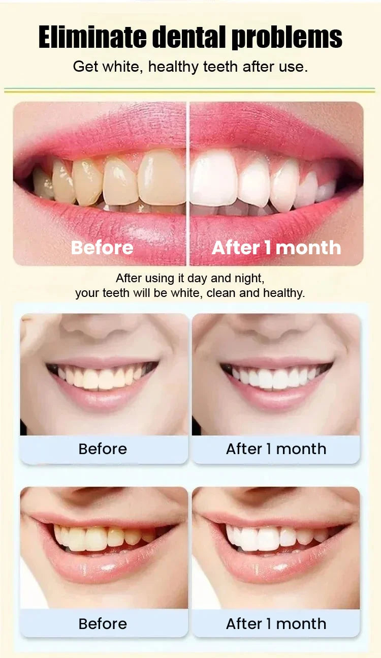 Sp-4 Probiotic Ultra Whitening Toothpaste